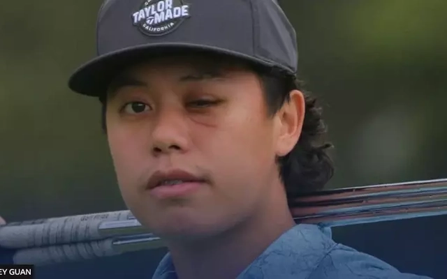 Jeffrey Guan và hành trình trở lại sân golf phi thường sau bi kịch mất một mắt