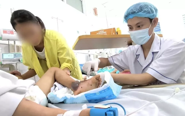 Bé trai 4 tuổi nguy kịch vì bà nội cho đắp thuốc nam chữa vết mèo cắn