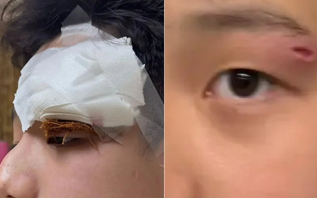 Một nữ diễn viên nổi tiếng làm 1 việc khiến con trai phải khâu tới 4 mũi