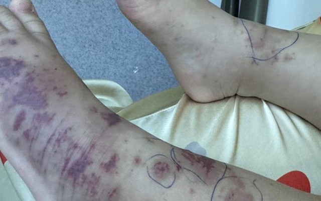 Chuyên gia cảnh báo về một căn bệnh nguy hiểm, lây lan nhanh, tỉ lệ tử vong cao