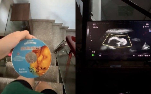 Clip siêu âm thai vừa tìm thấy và tâm thư người con làm dân mạng 'cay sống mũi'