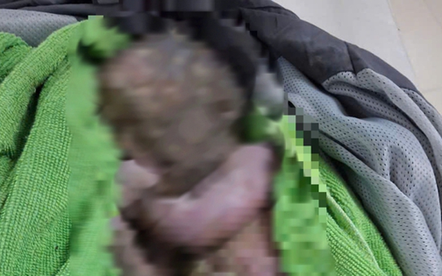 Cứu sống trẻ sơ sinh bị bỏ rơi đã ngừng tim, người đầy bùn đất