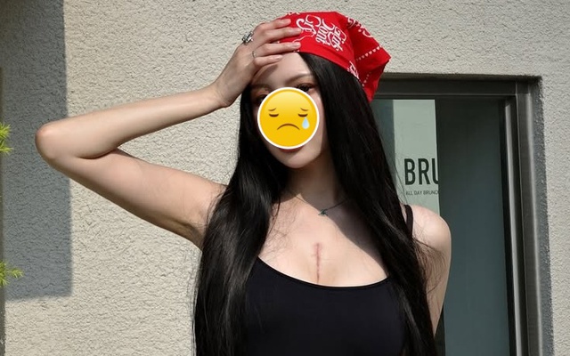 Nữ thần sắc đẹp 29 tuổi qua đời vào sáng nay vì mắc bệnh hiếm gặp