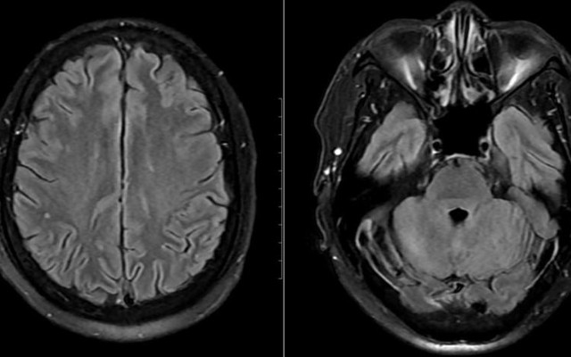 Cảnh báo hệ lụy từ món ăn "lấy may" của nhiều gia đình vào ngày Tết