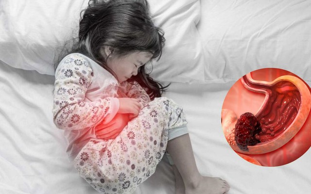 Bé gái 13 tuổi mắc ung thư dạ dày giai đoạn cuối, nguyên nhân đến từ thói quen của bố