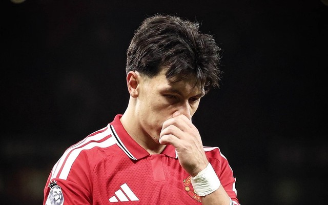 Martinez không xin lỗi, nói rõ lý do chỉ trích ban lãnh đạo Man Utd