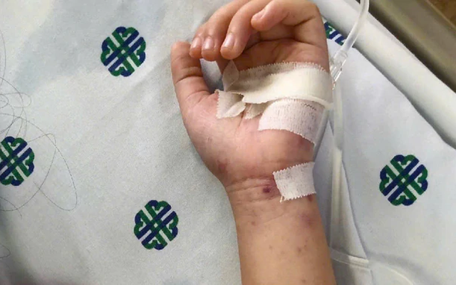 Thêm một ca não mô cầu tại TP.HCM, trẻ đã tiêm vaccine vẫn mắc bệnh: Bác sĩ cảnh báo 4 nhóm người có nguy cơ cao