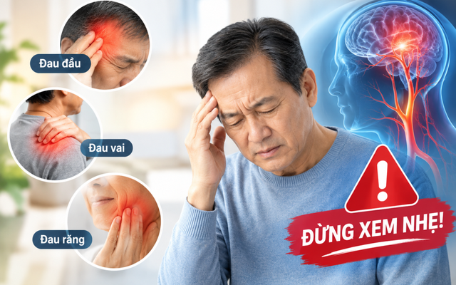 Đau ở 3 vùng này có thể là dấu hiệu sớm của đột quỵ, đừng xem nhẹ!