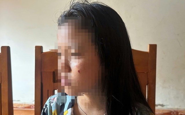 Vụ nữ sinh lớp 10 bị đánh, dí thuốc vào mặt ở Đắk Lắk: Nạn nhân không dám đi học