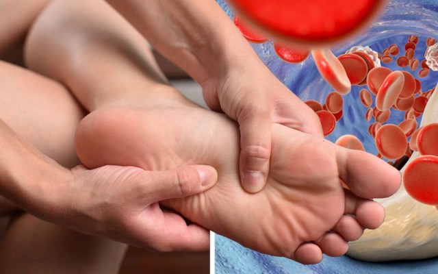 6 loại thực phẩm nếu ăn quá nhiều sẽ khiến axit uric trong máu tăng cao, "dẫn lối" cho bệnh thận và gout