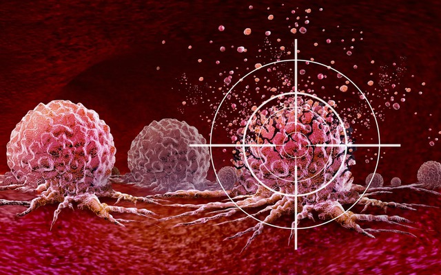 Ung thư rất ‘thích’ 2 loại thực phẩm này, chuyên gia cảnh báo: "Cần hạn chế ăn ngay lập tức"