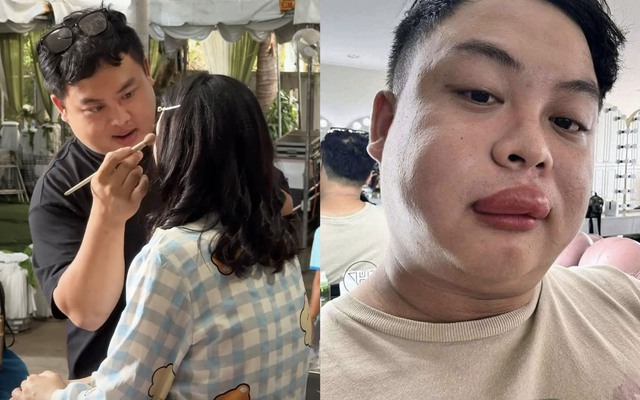 Cô dâu bị ong đốt, thợ make up đến “cứu” cũng bị đốt sưng môi: Người trong cuộc kể chuyện hy hữu