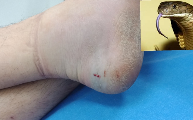 Thí sinh The Voice qua đời vì bị rắn độc cắn trong phòng ngủ