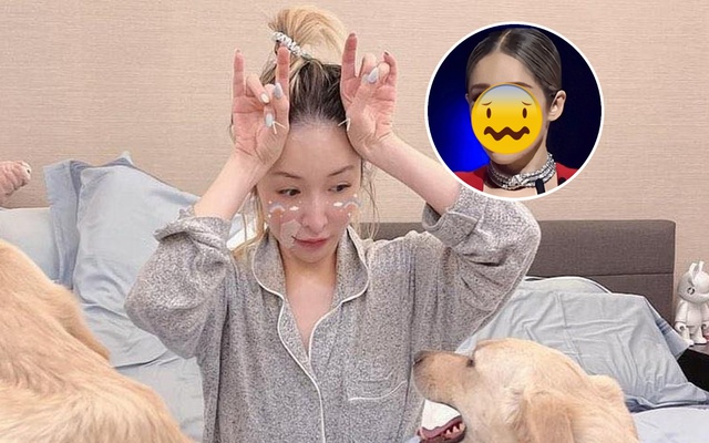 Nữ ca sĩ bị tai nạn đến hủy dung: Vết thương hoại tử 2 tháng, giờ gây sốc với "gương mặt rắn" méo mó