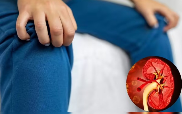 Muốn biết thận khỏe hay yếu, cứ nhìn vào tay và chân sẽ rõ: Có 7 dấu hiệu này thì phải đi khám sớm!