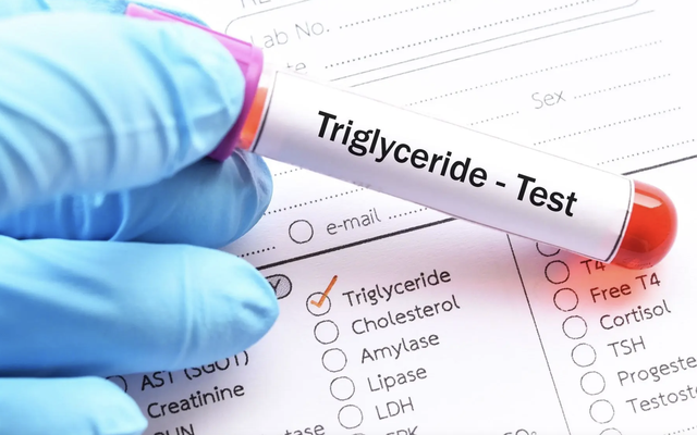 Người đàn ông U40 máu trắng đục như sữa, bác sĩ chỉ đích danh sai lầm khiến mỡ máu tăng vọt