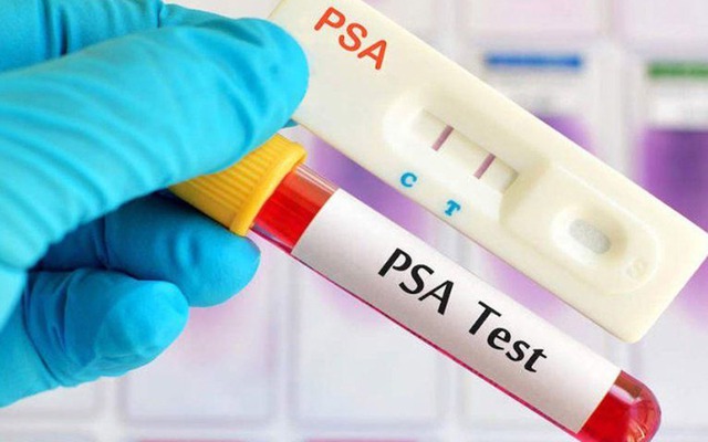 3 ca ung thư tuyến tiền liệt trong 1 ngày, bác sĩ chỉ lý do bệnh dễ bị bỏ sót