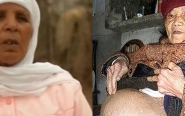 Người phụ nữ mang thai suốt 46 năm mà không hề hay biết cho đến khi 75 tuổi