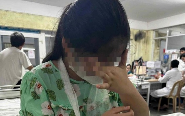 Cô giáo dùng thước gỗ đánh gãy tay học sinh lớp 4: Gia đình tiết lộ nguyên nhân