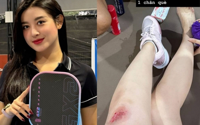 Á hậu Huyền My gặp tai nạn khi chơi pickleball