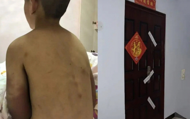 Bi kịch của cậu bé 14 tuổi vẫn phải mặc tã