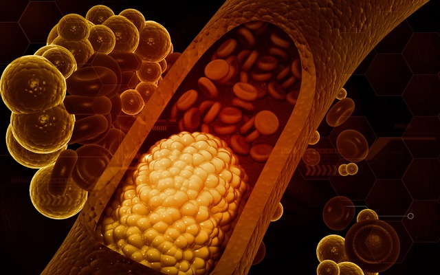 Ăn nhiều rau luộc, ít thịt cả 3 bữa trong ngày nhưng mỡ máu vẫn cao vút: Bất ngờ với "thủ phạm"