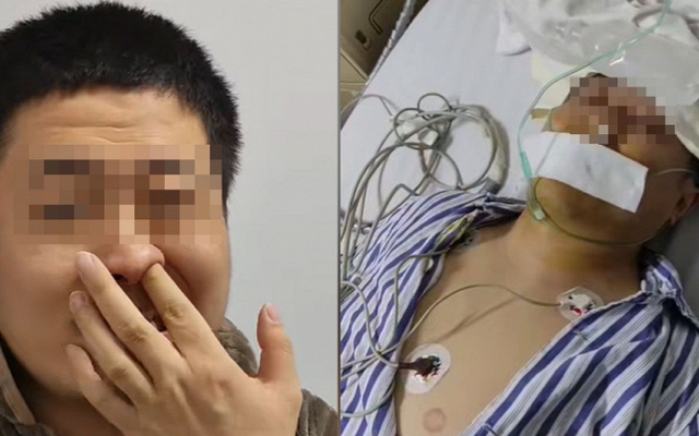 Người đàn ông bị tổn thương não vĩnh viễn vì xì mũi quá mạnh: Bạn có đang làm việc này đúng cách?