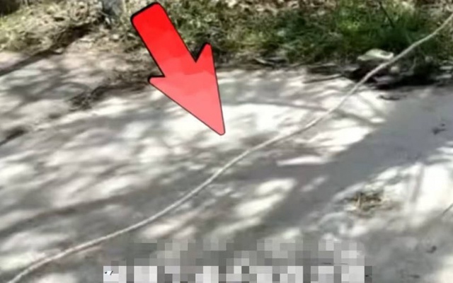 Đạp xe vướng dây giăng ngang đường, cậu bé bị siết cổ đến vỡ khí quản, nguy kịch