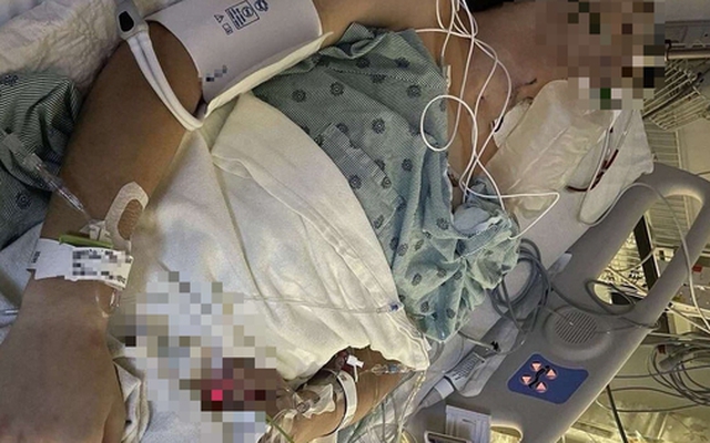 Chàng trai 26 tuổi phải cắt bỏ hơn 10cm "cậu nhỏ" vì bỏ qua 1 thứ ai cũng tưởng tắm... chưa kỹ