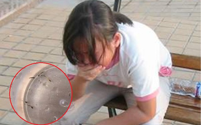 Bé gái nôn ra “giun sống” suốt hơn 1 tháng, thủ phạm lại là loài đang có trong nhiều gia đình