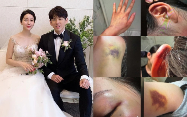 Anh trai Jisoo (BLACKPINK) lại trở thành tâm điểm phẫn nộ: Bị tố bạo hành gia đình, bắt vợ phải quỳ gối xin tha?