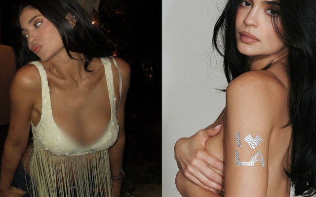 Tình hình của Kylie Jenner sau nghi vấn vỡ túi ngực ở Coachella