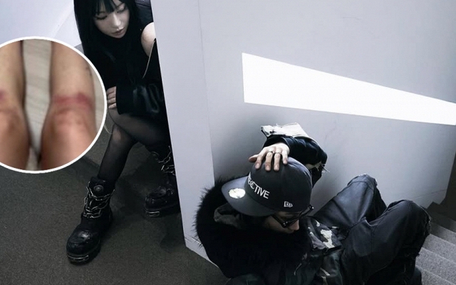 Nữ ca sĩ yêu lại bạn trai cũ từng đánh cô bầm dập toàn thân: “Tôi không kiện anh ấy nữa”