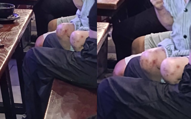 Bé gái xuất hiện tại quán "bar beer" ở Hà Nội với nhiều dấu hiệu bất thường: Kết quả xác minh