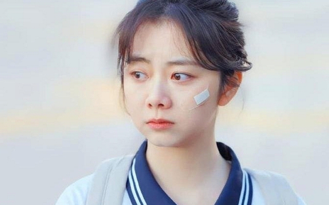 Đàm Tùng Vận gặp tai nạn nghiêm trọng khi quay phim, đôi môi gần như đứt lìa