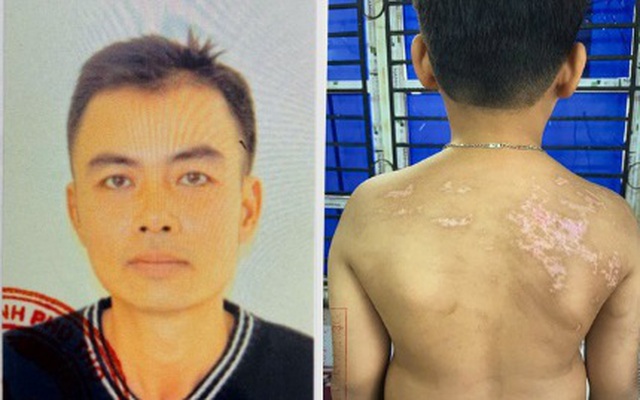 Thi hành Lệnh bắt tạm giam Nguyễn Hà Chung, nạn nhân là con ruột mới hơn 7 tuổi