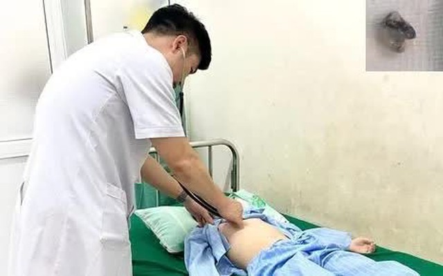 Nguy hiểm: Nhổ răng tại nhà, bé trai nguy kịch vì răng rơi vào phổi