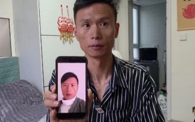 Chi 35 triệu mua thuốc tăng cân trên mạng, người đàn ông uống xong liền giảm 6,5kg