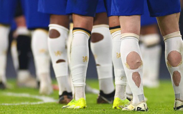 Phát hiện nhiều cầu thủ World Cup đi tất rách ra sân