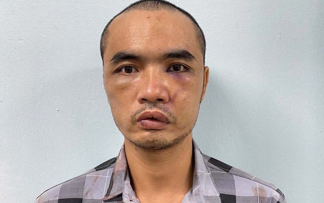Kẻ dùng dao chém loạt kính ô tô đỗ trên phố Hà Nội khai gì?