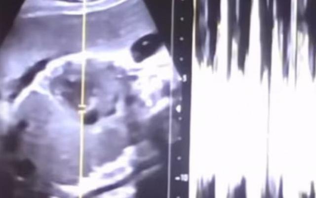 Bê bối phá thai 36 tuần tuổi, giám đốc bệnh viện sản bị cáo buộc giết người