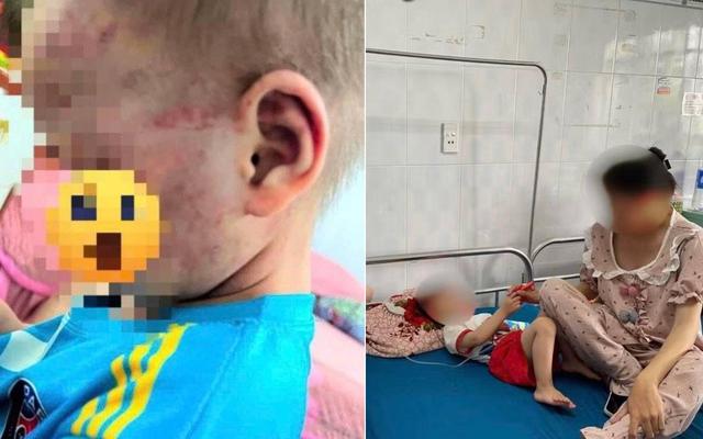 Đi làm về thấy chồng xin lỗi, vợ chết lặng khi nhìn vào mặt con, lập tức báo công an