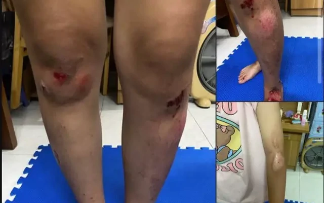 Công an xác minh thông tin vụ 2 cô gái bị đánh sau va chạm giao thông