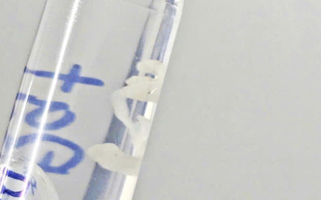 Bác sĩ kéo "thứ lạ" dài 7cm trong đùi người đàn ông Hà Nội: Nghi do một lần đi tắm cùng bạn bè