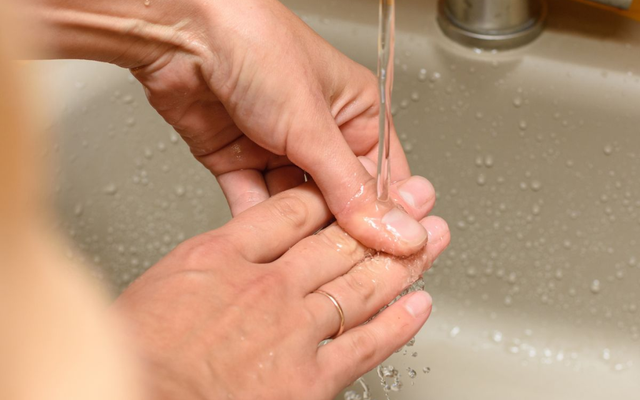 Bác sĩ cảnh báo: Bị bỏng mà làm điều này ngay lập tức có thể khiến vết thương lâu lành hơn, đáng tiếc nhiều người vẫn làm