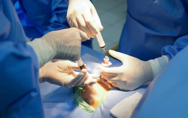 Thực hiện thành công ca ghép tuỷ từ người hiến nhỏ nhất Việt Nam