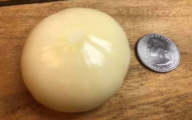 Trồng tỏi gần 1 năm, người đàn ông 67 tuổi đào lên rồi sững sờ: Một kỷ lục thế giới mới được xác lập!