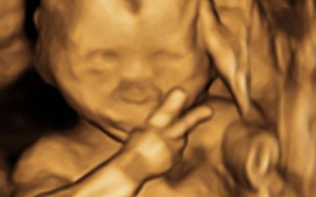Giật mình với những hình ảnh "lạ" xuất hiện khi siêu âm thai nhi