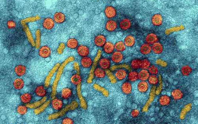 Mối liên quan giữa bệnh khô miệng và viêm gan siêu vi B