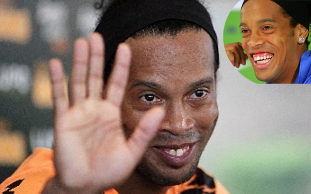 Ronaldinho mất giá vì phẫu thuật hàm răng thương hiệu